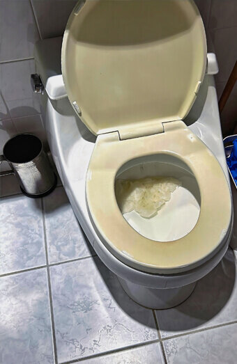 https://blockeddrainslandsdale.com.au/uploads/2025/07/blocked-toilet-27293.jpg